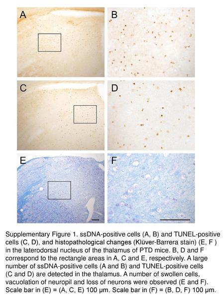 Supplementary Figure 1. ssDNA-positive cells (A, B) and TUNEL-positive