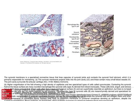 (c) Schematic representation of synovial membrane histology