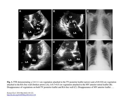 Fig. 1. TTE demonstrating a 2. 4×1