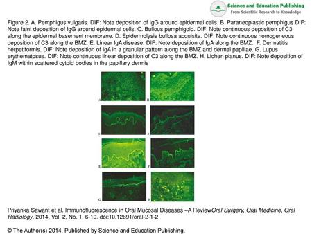 Figure 2. A. Pemphigus vulgaris