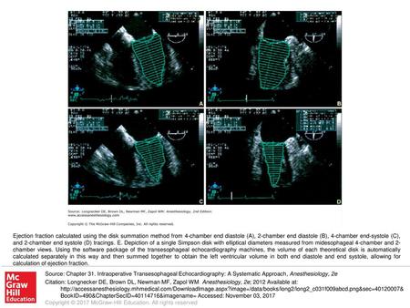 Ejection fraction calculated using the disk summation method from 4-chamber end diastole (A), 2-chamber end diastole (B), 4-chamber end-systole (C), and.