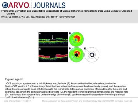 From: Error Correction and Quantitative Subanalysis of Optical Coherence Tomography Data Using Computer-Assisted Grading Invest. Ophthalmol. Vis. Sci..