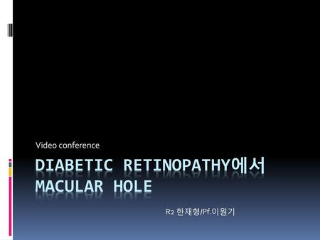 Diabetic retinopathy에서 Macular hole