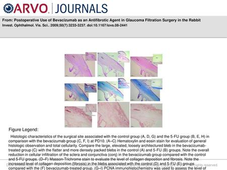 From: Postoperative Use of Bevacizumab as an Antifibrotic Agent in Glaucoma Filtration Surgery in the Rabbit Invest. Ophthalmol. Vis. Sci.. 2009;50(7):3233-3237.