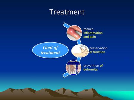 Treatment Goal of treatment reduce inflammation and pain