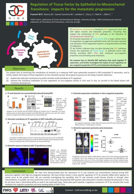 Epithelial-to-Mesenchymal Transitions Circulating Tumor Cells