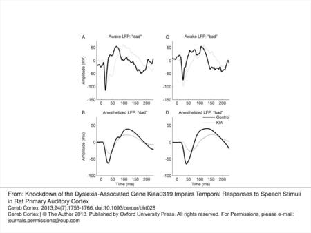 Figure 1. In utero RNAi of Kiaa0319 (KIA−) caused delayed speech-evoked LFPs in both awake and anesthetized rats. LFPs in panels (A) and (C) were created.