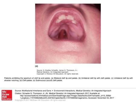 Patients exhibiting the spectrum of cleft lip and palate