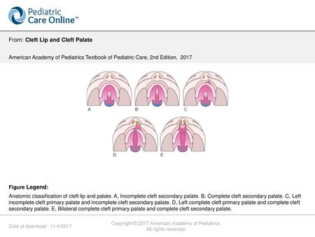 Copyright © 2017 American Academy of Pediatrics.