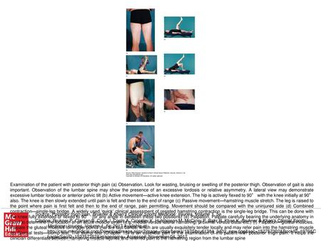 Examination of the patient with posterior thigh pain (a) Observation