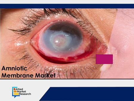 Opportunity Analysis and Industry Forecast, Amniotic Membrane Market.