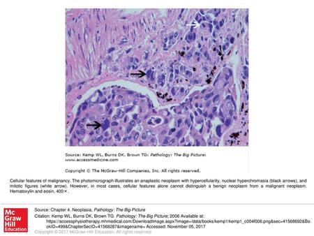 Cellular features of malignancy