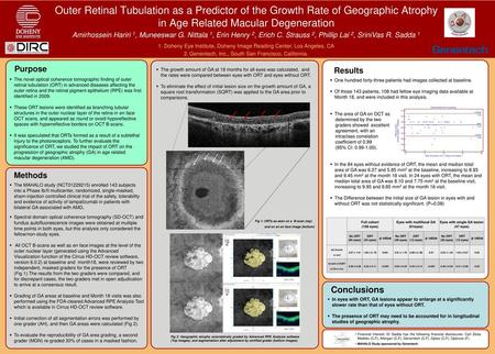 Outer Retinal Tubulation as a Predictor of the Growth Rate of Geographic Atrophy in Age Related Macular Degeneration Amirhossein Hariri 1, Muneeswar G.