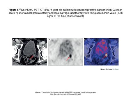 Nat. Rev. Urol. doi: /nrurol