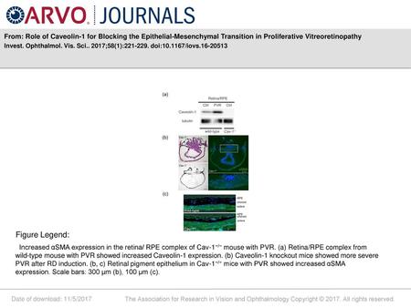 From: Role of Caveolin-1 for Blocking the Epithelial-Mesenchymal Transition in Proliferative Vitreoretinopathy Invest. Ophthalmol. Vis. Sci.. 2017;58(1):221-229.