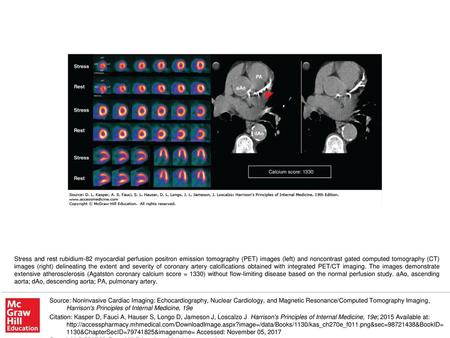 Stress and rest rubidium-82 myocardial perfusion positron emission tomography (PET) images (left) and noncontrast gated computed tomography (CT) images.