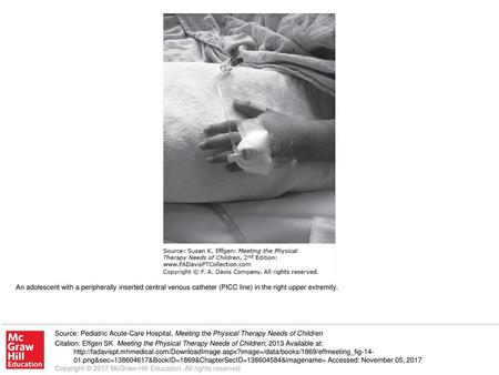 An adolescent with a peripherally inserted central venous catheter (PICC line) in the right upper extremity. Source: Pediatric Acute-Care Hospital, Meeting.