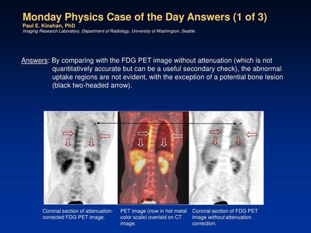 Monday Physics Case of the Day Answers (1 of 3) Paul E