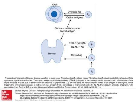 Proposed pathogenesis of Graves disease