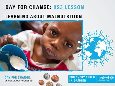 Malnutrition is only about being too thin   Not only does malnutrition cause a child to have low weight for their height, but it can also lead to.