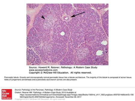 Pancreatic lobule. Grossly and microscopically normal pancreatic tissue has a lobular architecture. The majority of the lobule is composed of acinar tissue.