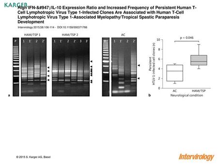 High IFN-γ/IL-10 Expression Ratio and Increased Frequency of Persistent Human T-Cell Lymphotropic Virus Type 1-Infected Clones Are Associated with Human.