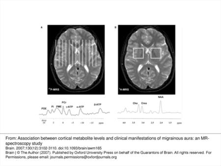 Fig. 1 (A) The figure shows the placement of the 1 cm thick sagittal slices in 31P-MRS. According to their position, slices were assigned to.