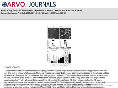 Invest. Ophthalmol. Vis. Sci ;44(9): doi: /iovs Figure Legend: