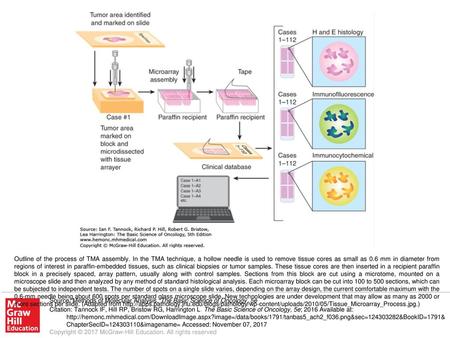 Outline of the process of TMA assembly