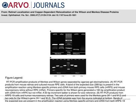 From: Retinal Localization and Copper-Dependent Relocalization of the Wilson and Menkes Disease Proteins Invest. Ophthalmol. Vis. Sci.. 2006;47(7):3129-3134.