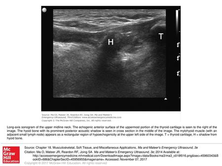 Long-axis sonogram of the upper midline neck