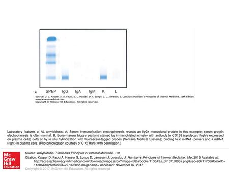 Laboratory features of AL amyloidosis. A