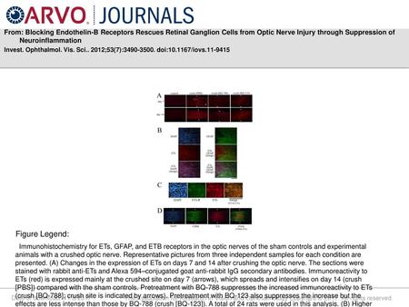 From: Blocking Endothelin-B Receptors Rescues Retinal Ganglion Cells from Optic Nerve Injury through Suppression of Neuroinflammation Invest. Ophthalmol.