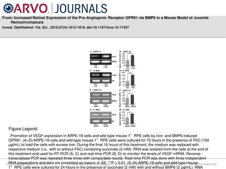 From: Increased Retinal Expression of the Pro-Angiogenic Receptor GPR91 via BMP6 in a Mouse Model of Juvenile Hemochromatosis Invest. Ophthalmol. Vis.