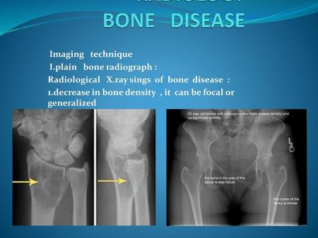 RADIOLOGY BONE DISEASE