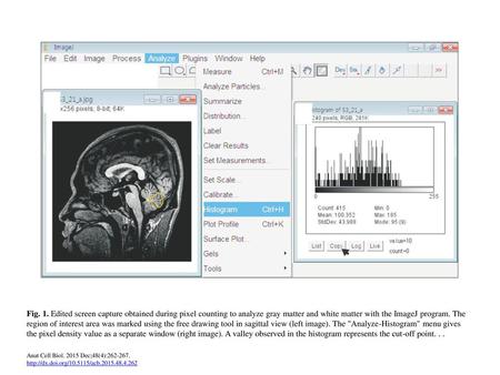 Fig. 1. Edited screen capture obtained during pixel counting to analyze gray matter and white matter with the ImageJ program. The region of interest area.