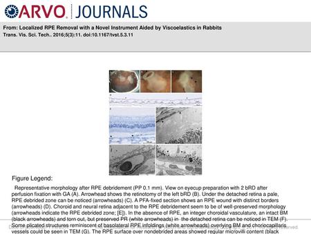 Trans. Vis. Sci. Tech ;5(3):11. doi: /tvst Figure Legend: