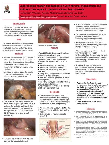 Laparoscopic Nissen Fundoplication with minimal mobilization and without crural repair in patients without hiatus hernia. HA Khokhar, W Fahmy, AA Toor,