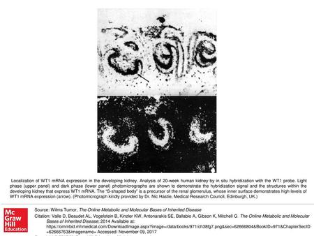 Localization of WT1 mRNA expression in the developing kidney