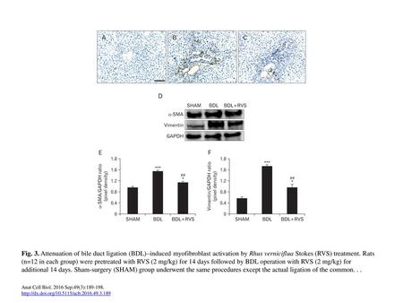 Fig. 3. Attenuation of bile duct ligation (BDL)–induced myofibroblast activation by Rhus verniciflua Stokes (RVS) treatment. Rats (n=12 in each group)