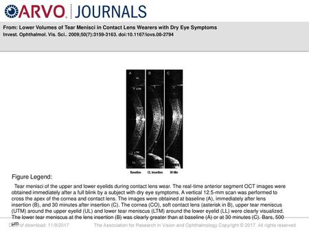 Invest. Ophthalmol. Vis. Sci ;50(7): doi: /iovs Figure Legend: