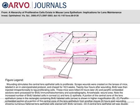 From: A Hierarchy of Proliferative Cells Exists in Mouse Lens Epithelium: Implications for Lens Maintenance Invest. Ophthalmol. Vis. Sci.. 2006;47(7):2997-3003.