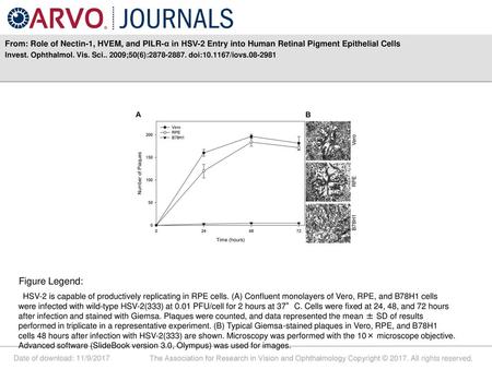 Invest. Ophthalmol. Vis. Sci ;50(6): doi: /iovs Figure Legend: