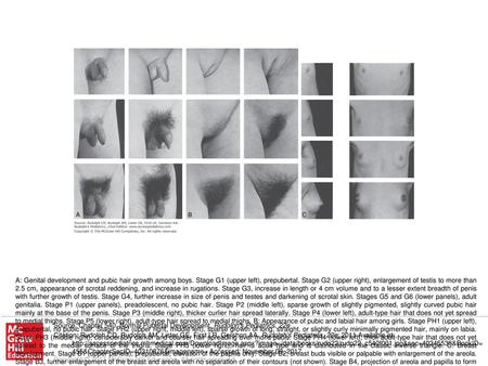 A: Genital development and pubic hair growth among boys