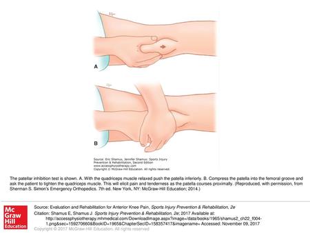 The patellar inhibition test is shown. A