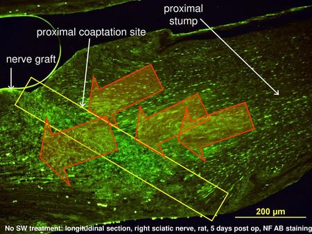 proximal coaptation site