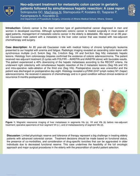 Neo-adjuvant treatment for metastatic colon cancer in geriatric patients followed by simultaneous hepatic resection: A case report Sotiropoulos GC, Machairas.