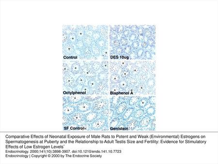 Figure 1. Effect of neonatal treatment with vehicle (Control), DES (10 μg), Bis-A, or OP; maintenance of rats on a soy-free diet (SF control); or the administration.