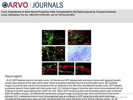 From: Engraftment of Adult Neural Progenitor Cells Transplanted to Rat Retina Injured by Transient Ischemia Invest. Ophthalmol. Vis. Sci.. 2003;44(7):3194-3201.