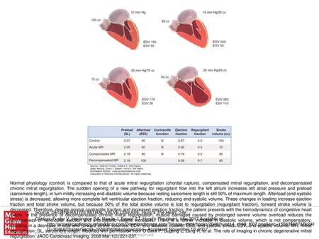 Normal physiology (control) is compared to that of acute mitral regurgitation (chordal rupture), compensated mitral regurgitation, and decompensated chronic.